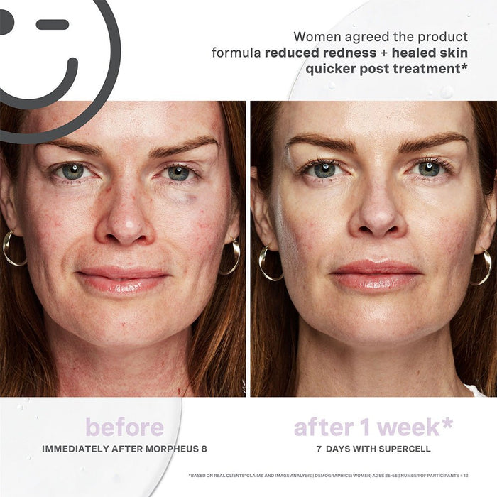 Kate Somerville Kateceuticals Supercell Rejuvenation Serum - 1oz/30 - Beauty Tribe