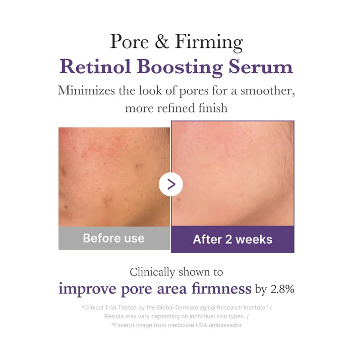 MEDICUBE Retinol NMN Radiance Booster 1.9% Serum 30 ml - DOKAN